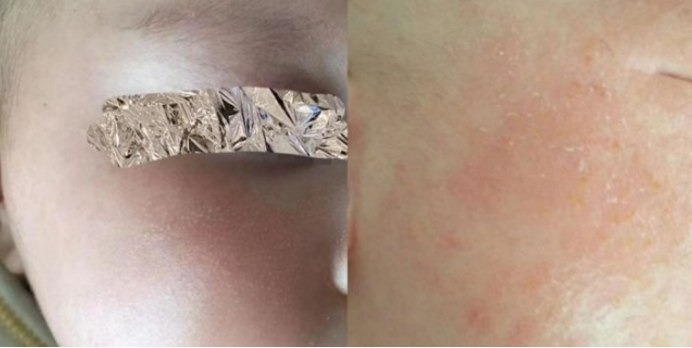 哪些激素面霜不能给宝宝用,怎么辨别小孩的面霜含不含激素