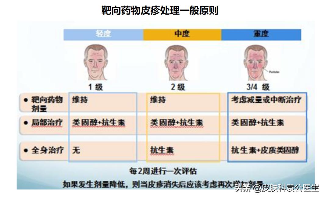 靶向加免疫治疗皮疹怎么处理,服用靶向药起皮疹怎么办