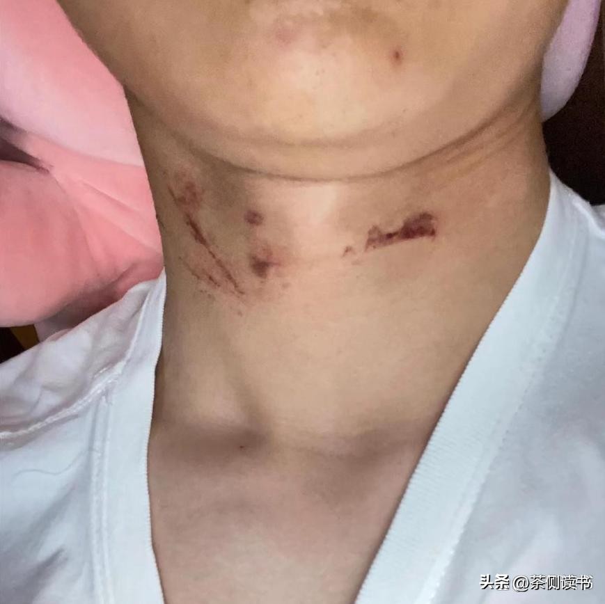 宜宾一电缆吊起摩托骑士，电缆的主人找到了