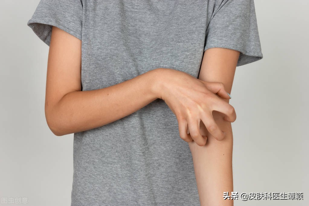 皮肤科疥疮的正确治疗,皮肤科医生怎么样确诊疥疮