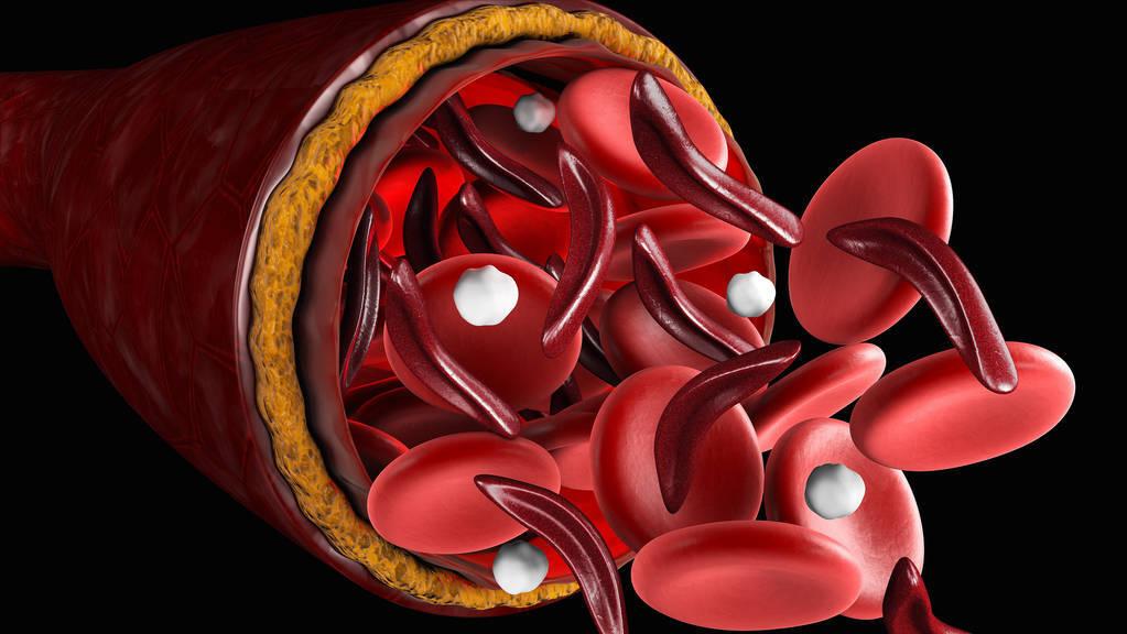 女性一直出血是什么原因引起的,女性出血是什么原因导致的