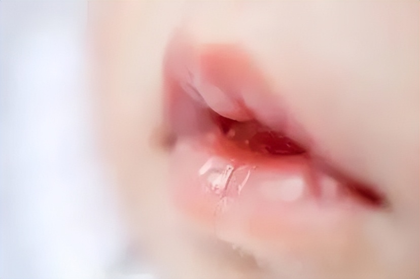 宝宝口腔有小白点是什么原因,五个月宝宝口腔上颚有白块图片