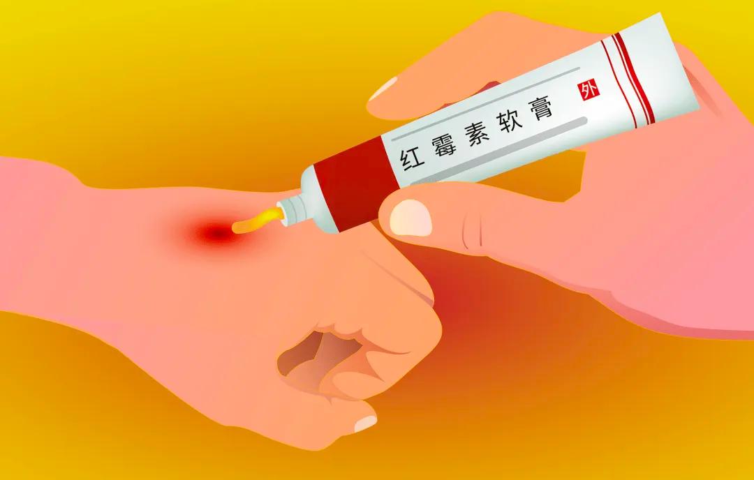 红霉素软膏涂眼睛的副作用,红霉素软膏用在眼部一次有影响吗