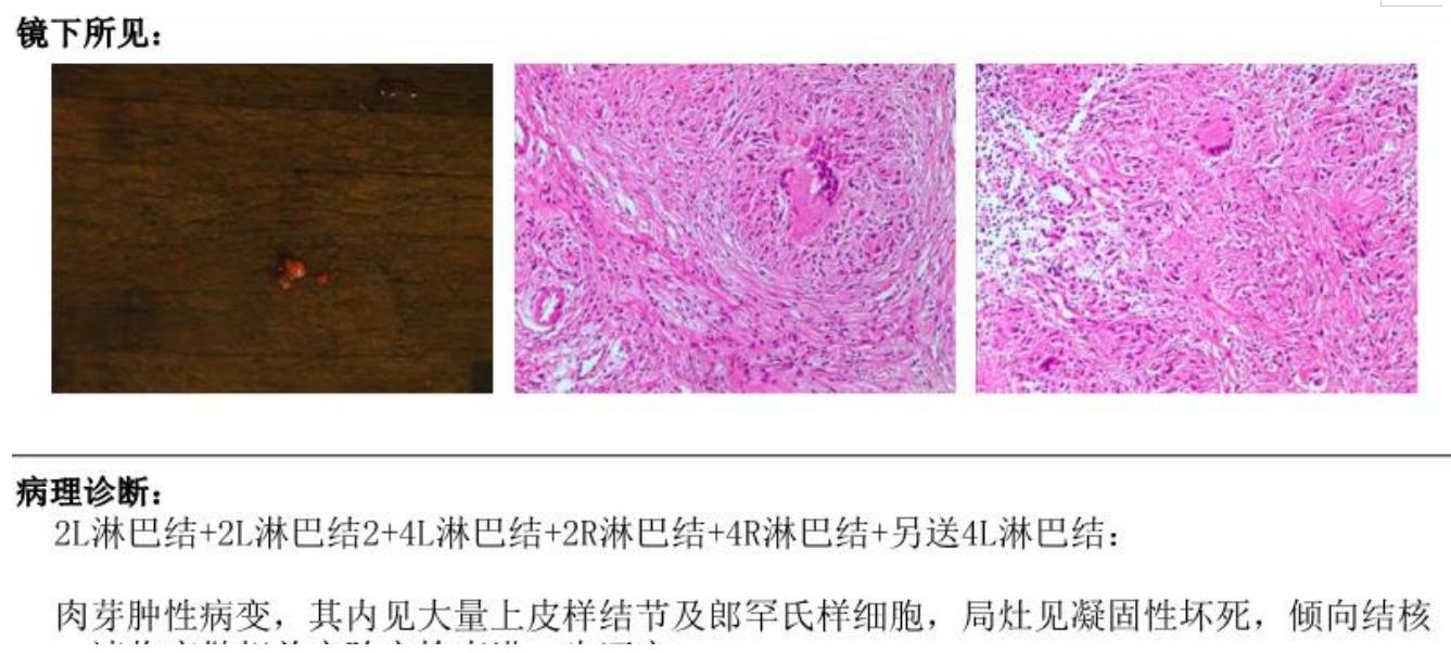 杨弘中山大学肿瘤,杨弘医生怎么样