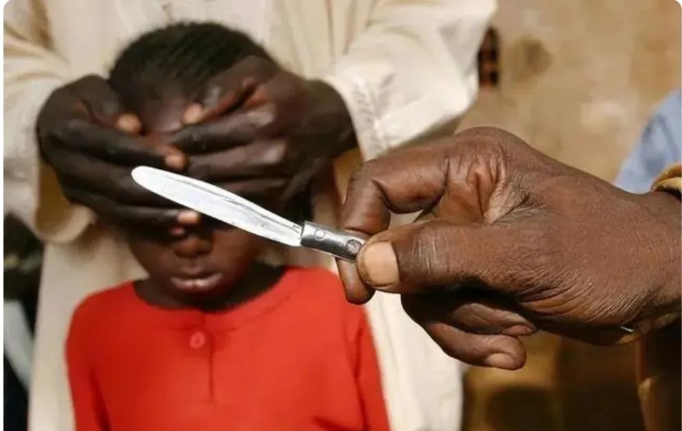 非洲阉割女孩的陋习已延续了4000年，仍旧存在着。让人谈之色变