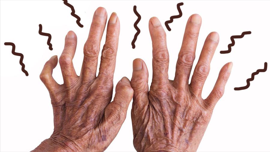 经常手抖、手麻，是怎么回事？医生：身体可能出现了问题，别大意
