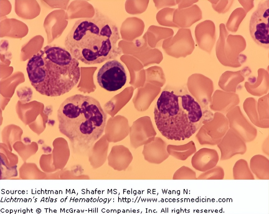 10岁孩子总头疼，发现是大脑异常？医生提醒：小孩别玩非洲大蜗牛