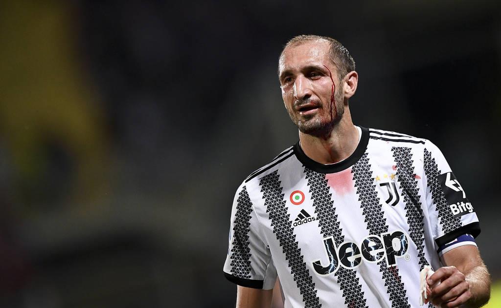 博努奇和基耶利尼退役,基耶利尼履历