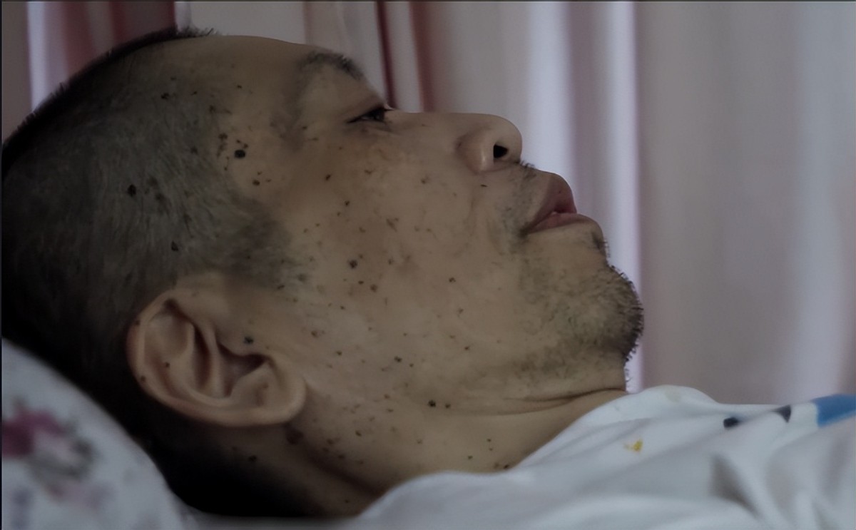 对癌症患者的临终关怀,癌症患者临终关怀