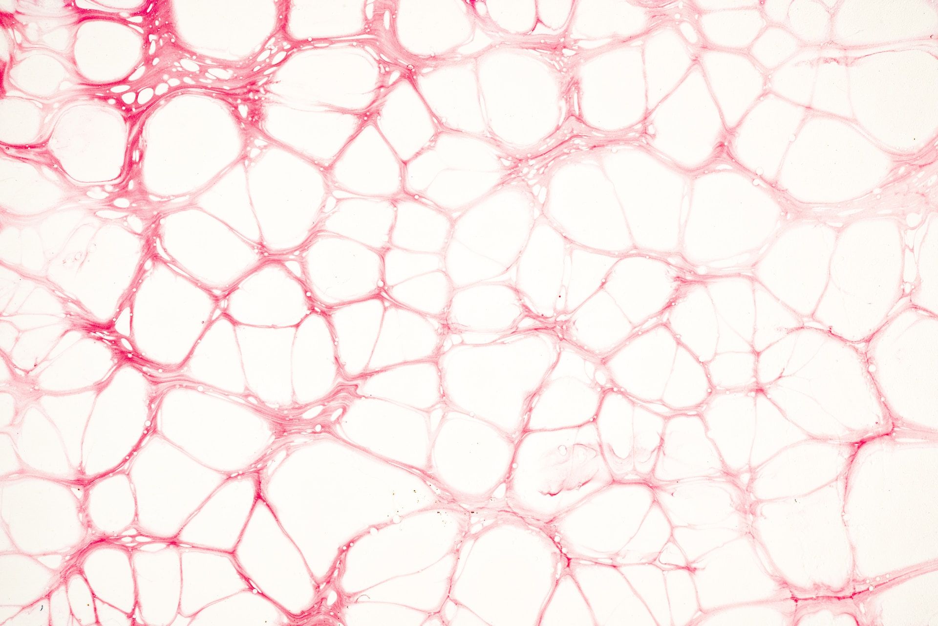 中暑发烧后头痛怎么缓解,中暑是什么症状中暑吃什么药