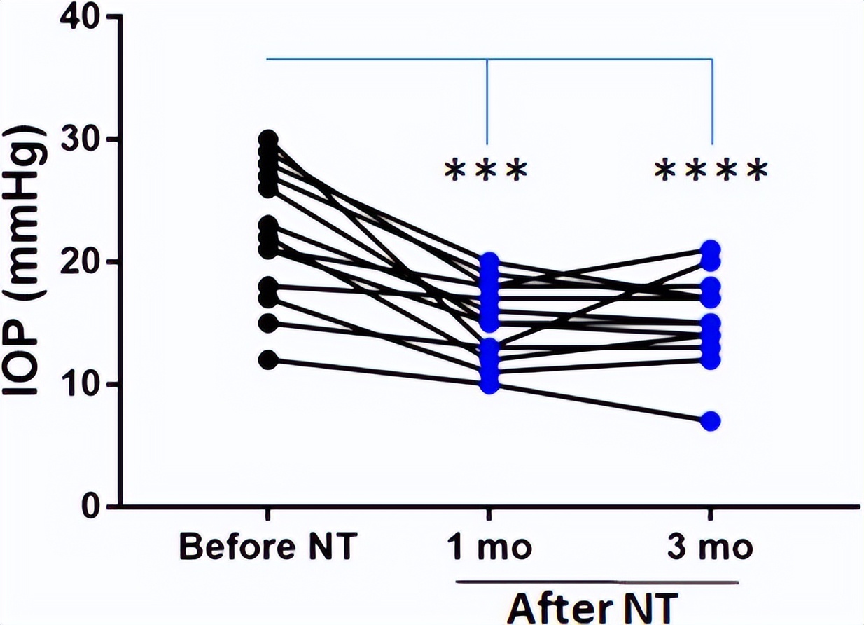 rho激酶抑制剂多少钱,rho激酶抑制剂是什么