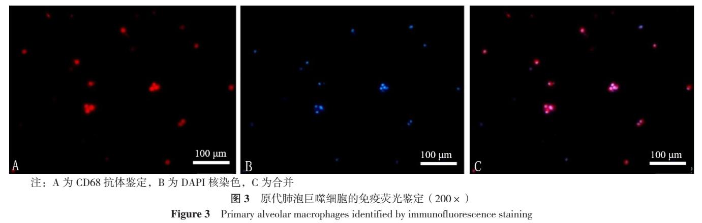 银杏叶提取物预防心脑血管病怎样,银杏叶提取物治什么病的