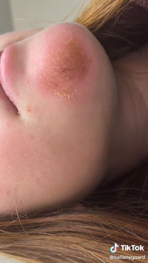 澳洲妹子和男友接吻,澳大利亚女子与男友接吻