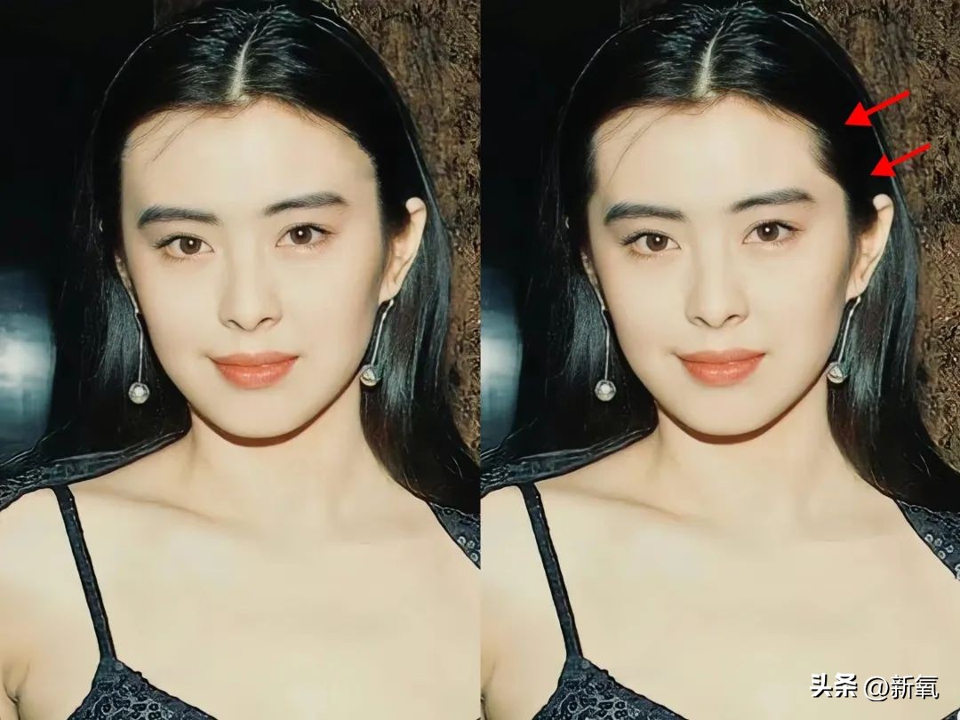 高颅顶怎么掩饰发际线,高颅顶会显得发际线低吗