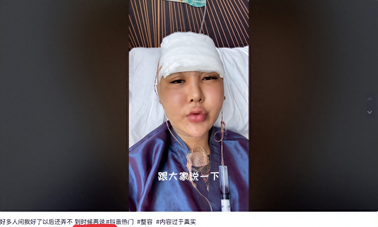 网红整容毁容真实案例,各大网红整容之后的后果
