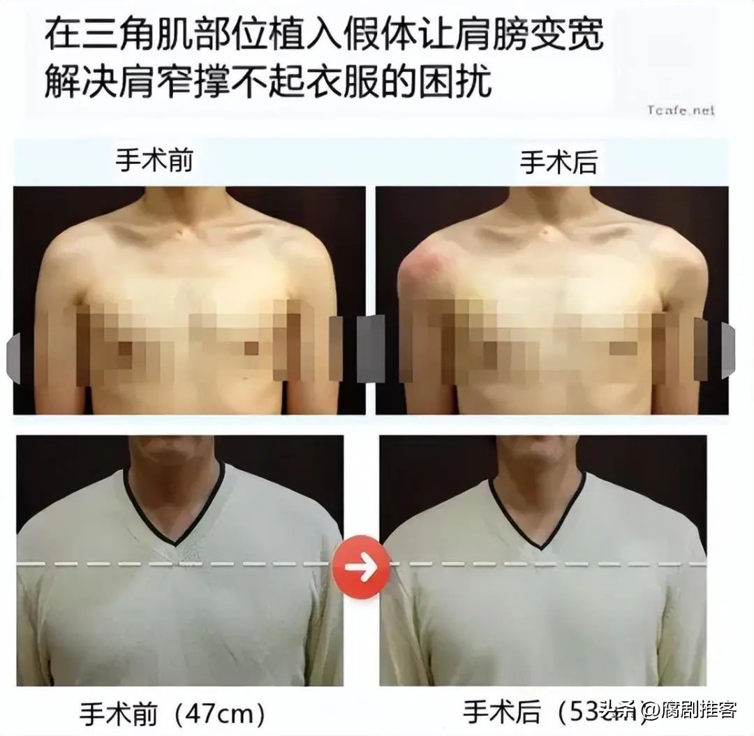 韩国男人为什么喜欢双开门,韩国人为什么都喜欢双开门