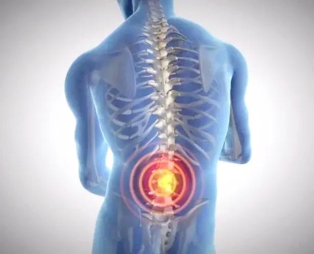 腰痛是怎么回事有什么方法,腰痛有几种症状分别怎么治疗