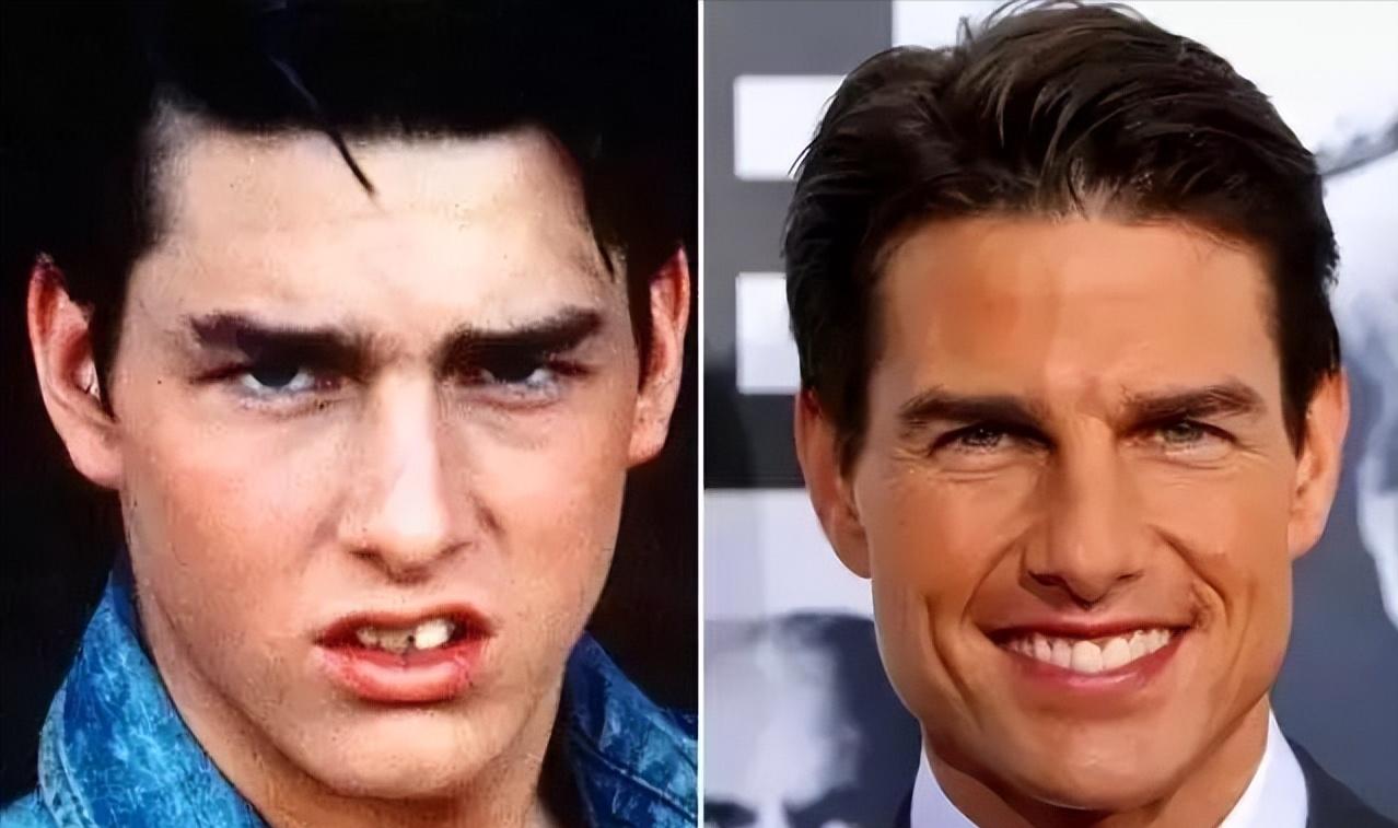 明星的牙都很齐吗,明星的牙齿都很好看