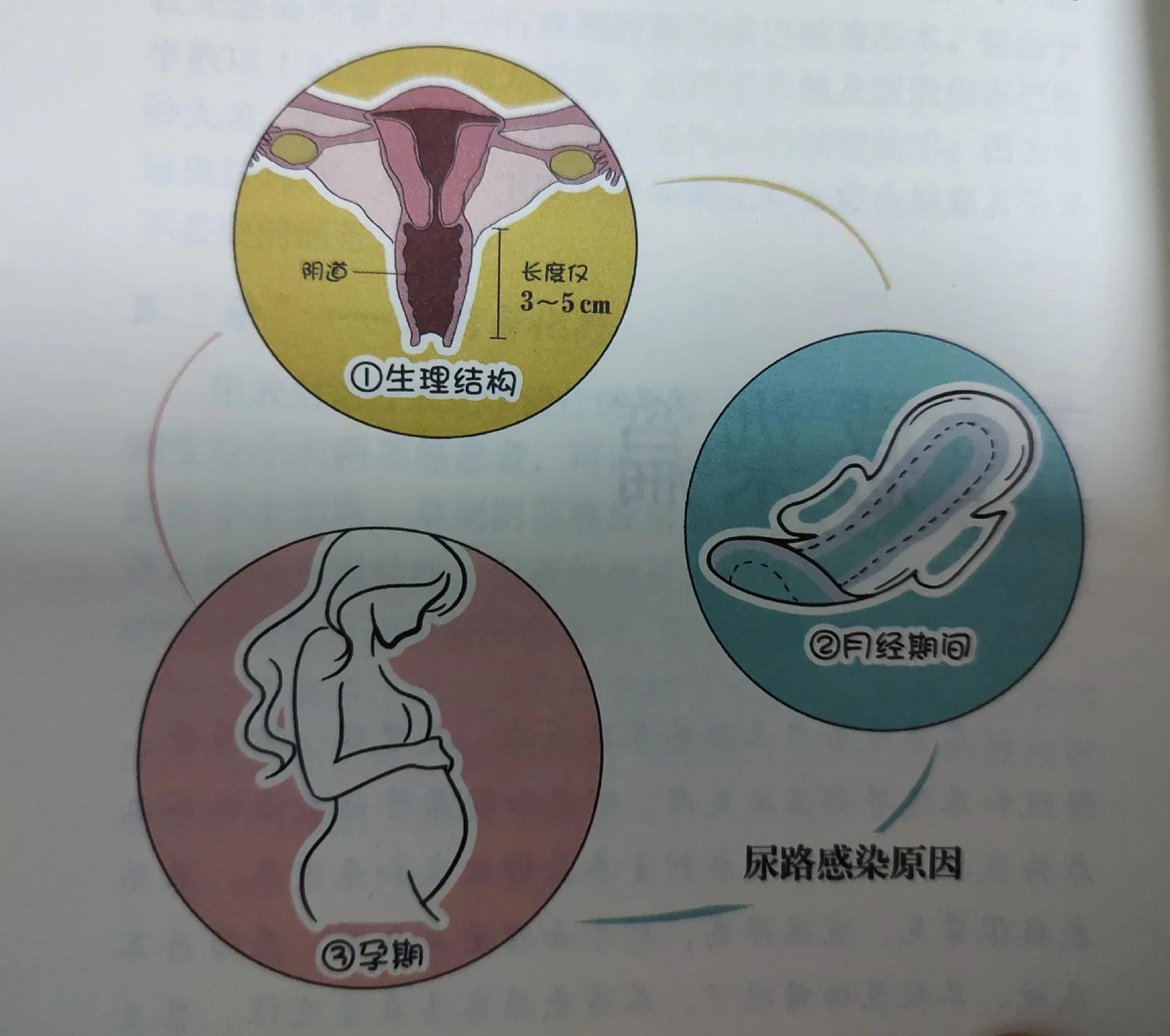女性泌尿感染尿血多久能好,更年期女性泌尿感染怎么办