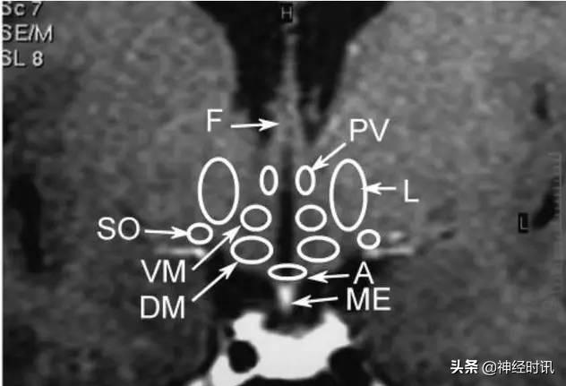下丘脑及垂体解剖结构,下丘脑解剖和机能特点英文版