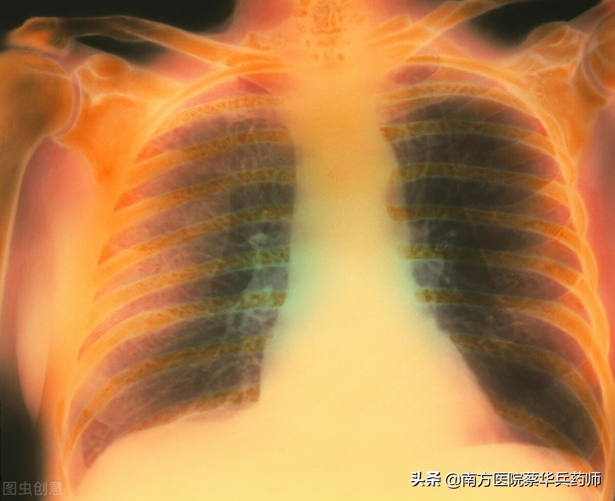 苓甘五味姜辛汤治肺气肿吗,轻度肺气肿白痰多的中药方