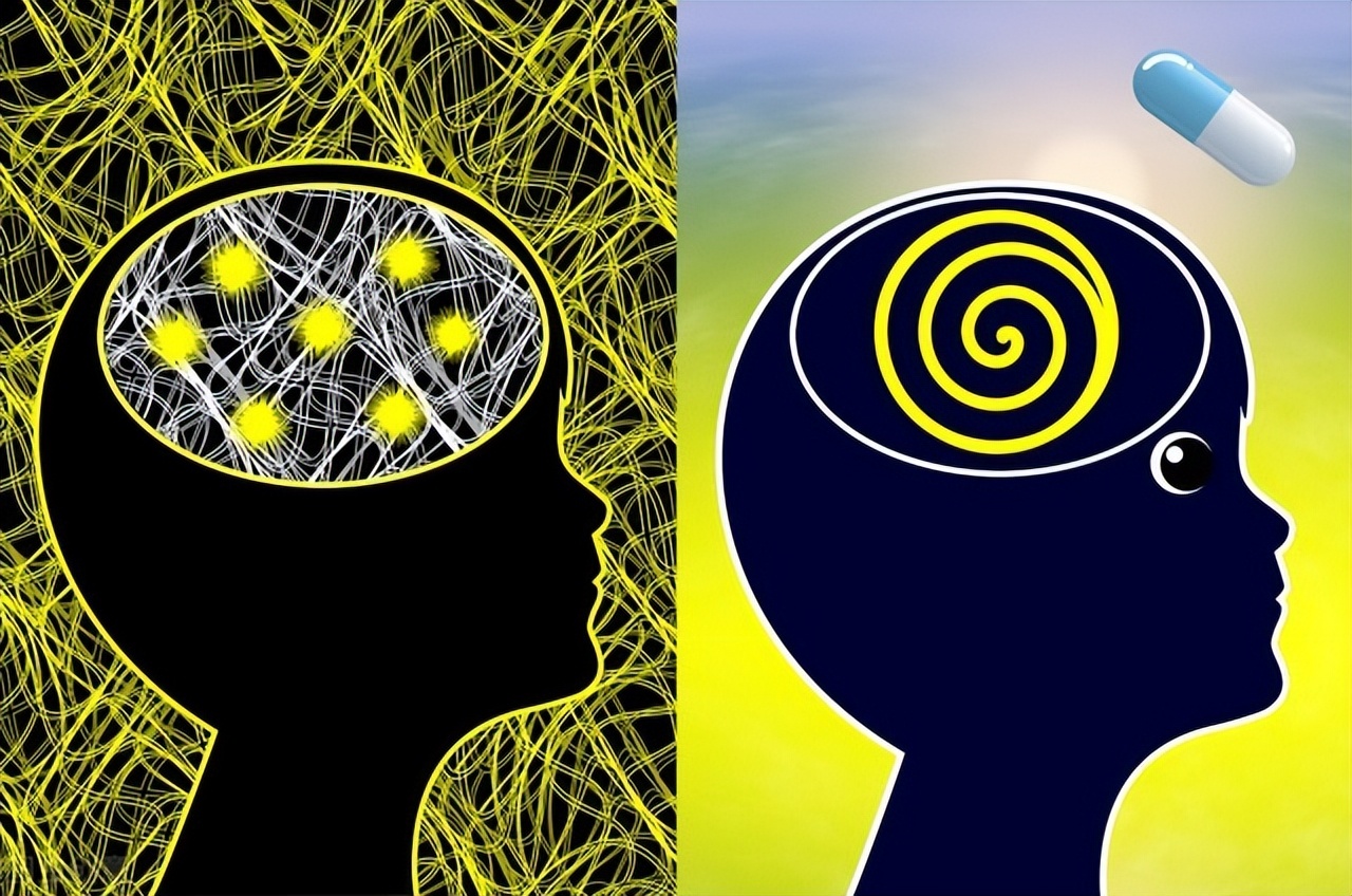 成人癫痫病典型失神发作的表现,失神发作的癫痫病吃什么药最佳