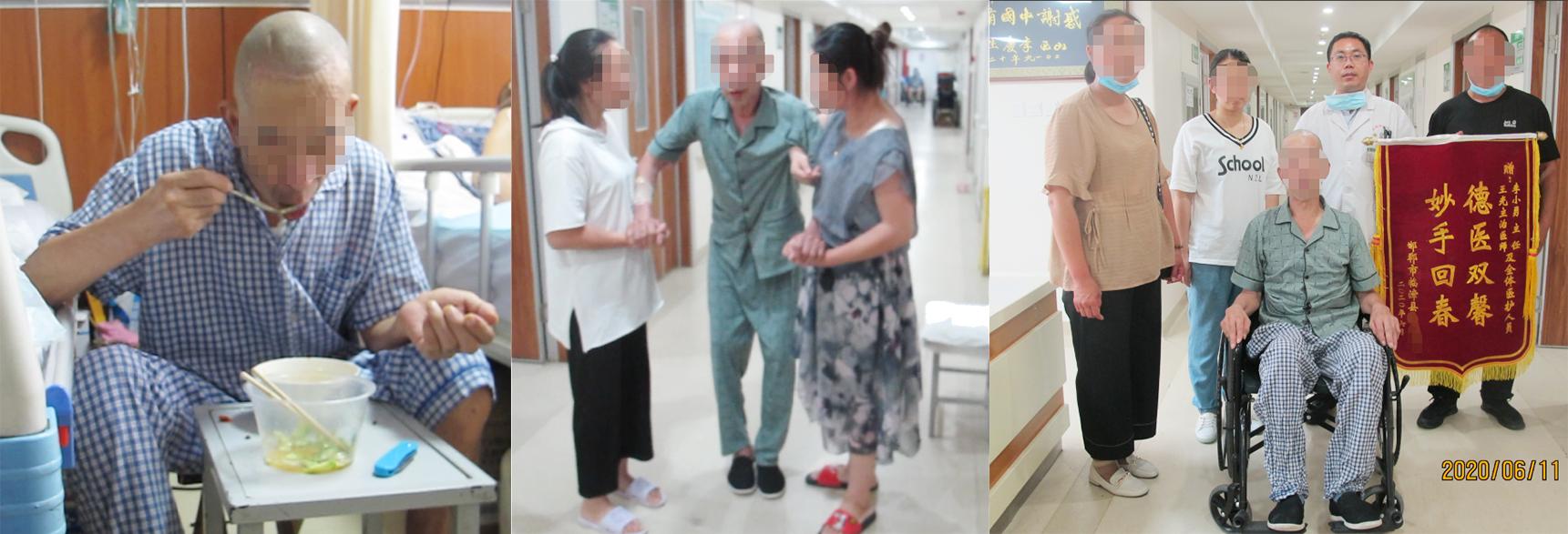 脑外伤后硬膜下积液颅骨修补,颅骨修复手术失败导致脑积水