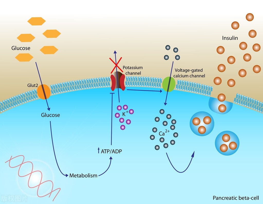 糖尿病干细胞移植能治好费用多少,一型糖尿病干细胞移植可以治愈不