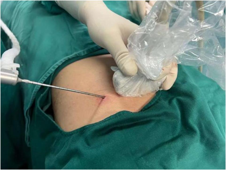 癌疼痛难忍,癌痛受不了热敷好多了