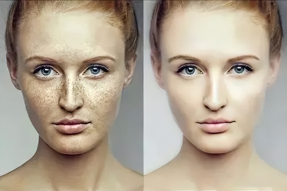 韩国东星小黑瓶祛斑霜，​韩国东星制药60年口碑企业出品！