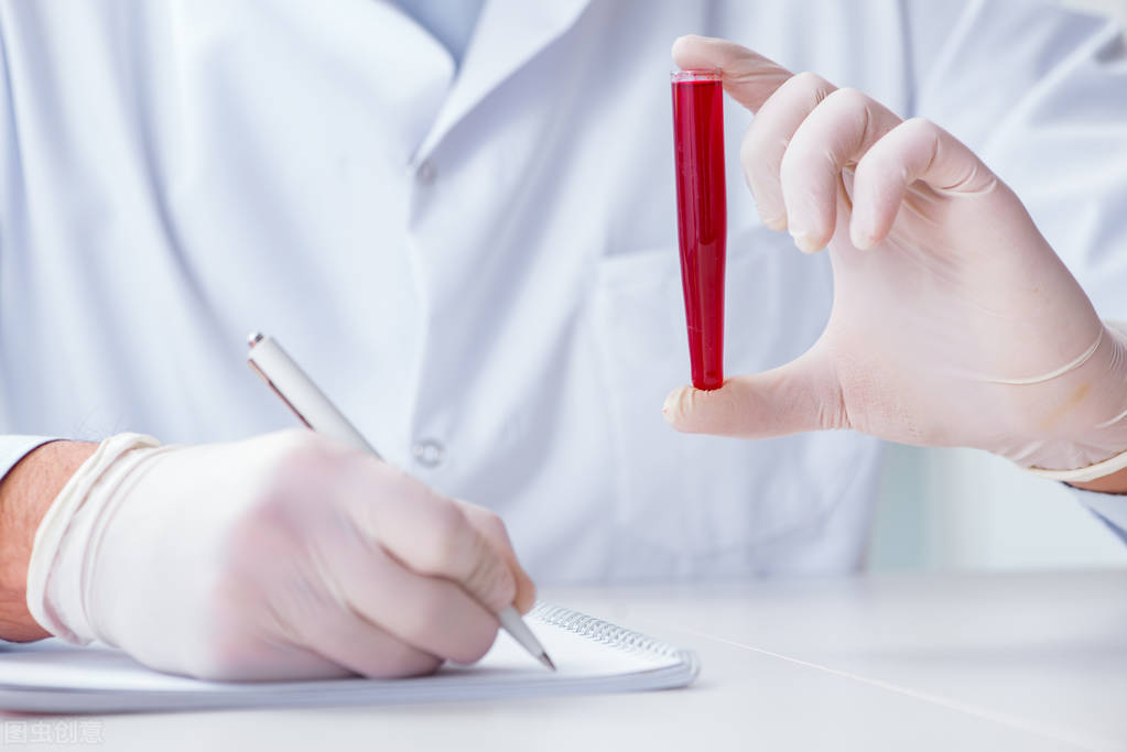 如何查血粘度,血液粘稠度要检查什么