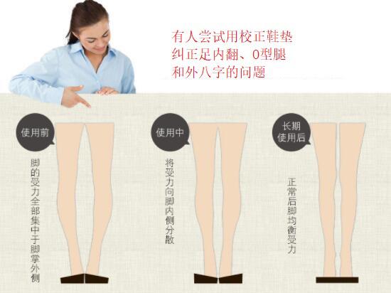 为什么会有o型腿,o型腿最有效矫正