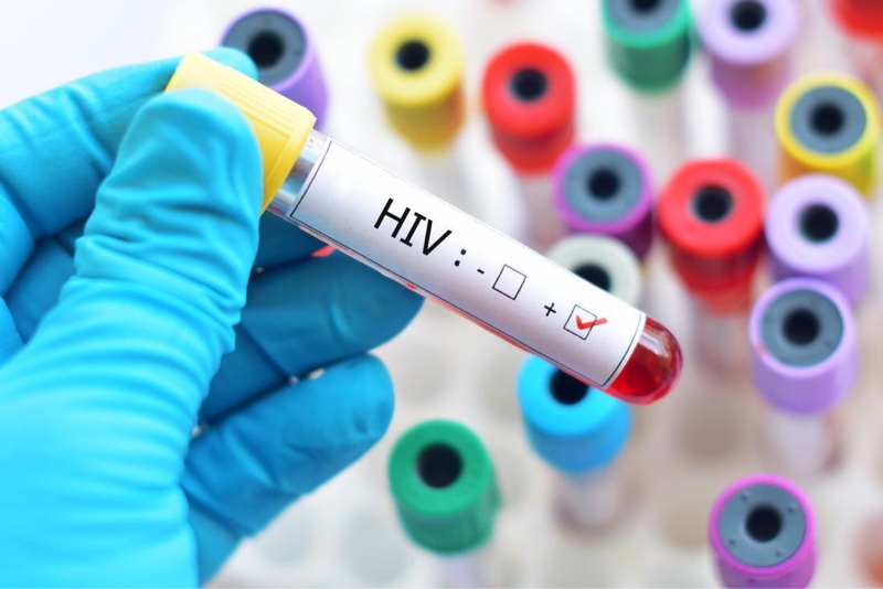 hiv阳性配偶怀孕用不用阻断,hiv阳性男性