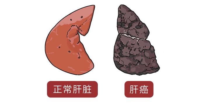 每天揉一揉腹部的正确方法,怎么按揉才能缓解肚子