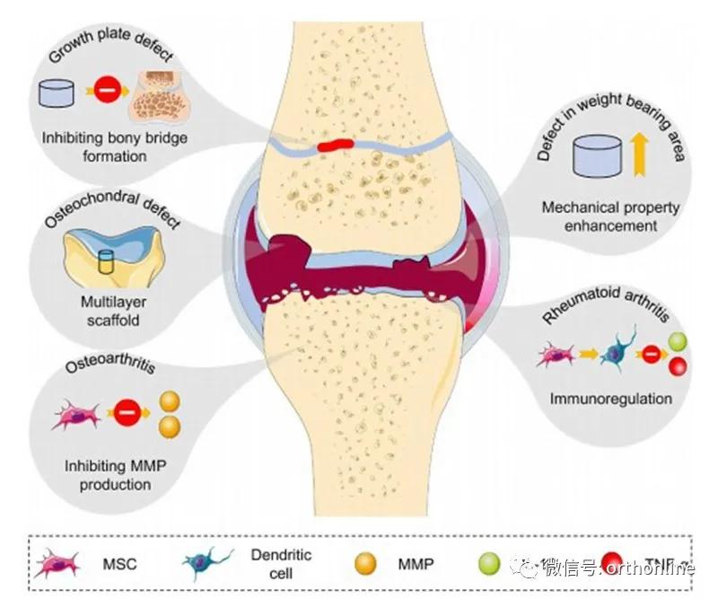 林剑浩：2021年骨科再生领域基础研究进展