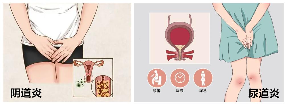 关于饮食健康的常见误区,女性健康误区有哪些