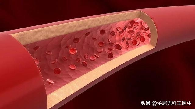 肝硬化失代偿期浑身瘙痒吃什么药,皮肤瘙痒检查竟是肝脏问题