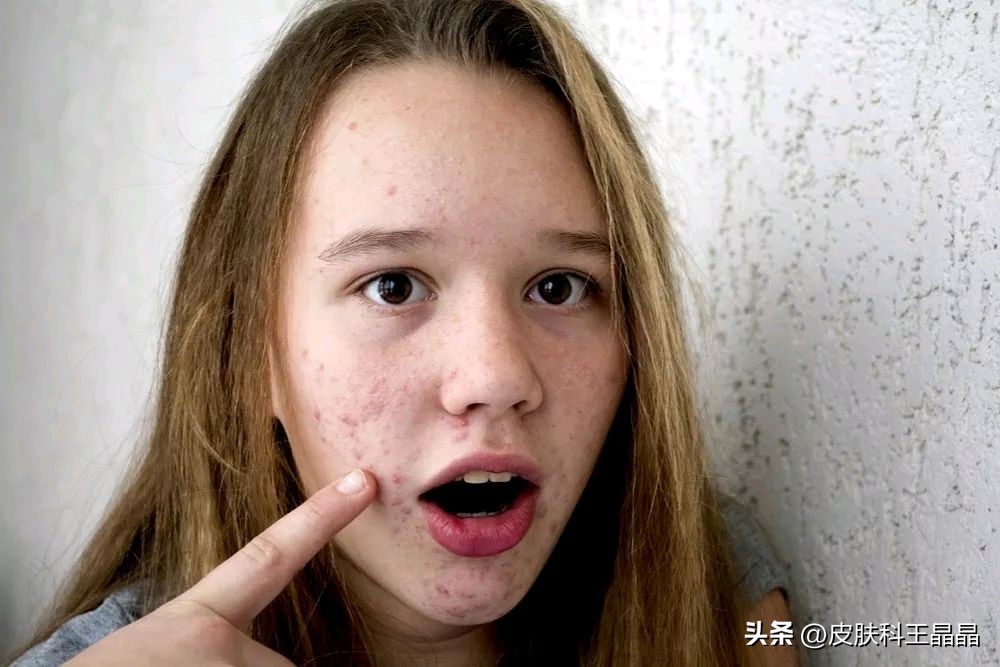 色斑用任何方法都祛不掉怎么办,色斑应该治吗