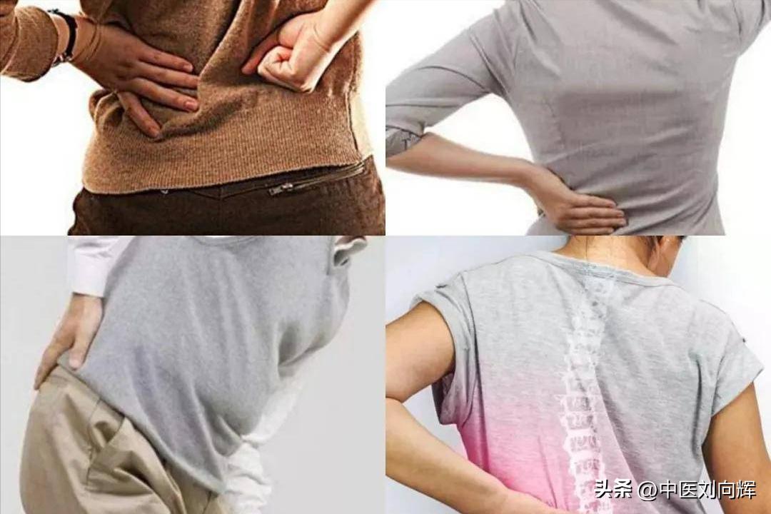 腰肌劳损，疼的直不起腰？中医送你一个中成药，补肾阳，强腰椎