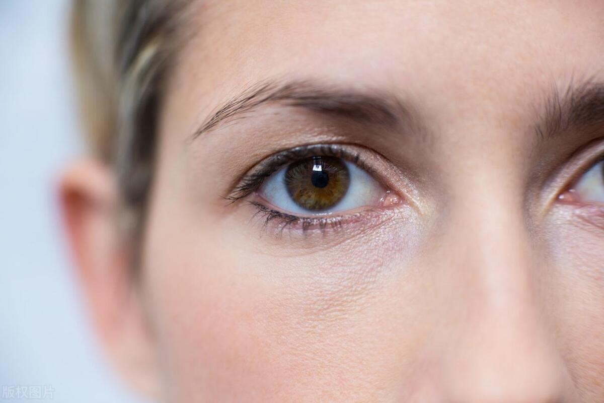 双眼皮有哪几种形状,双眼皮都有什么形状