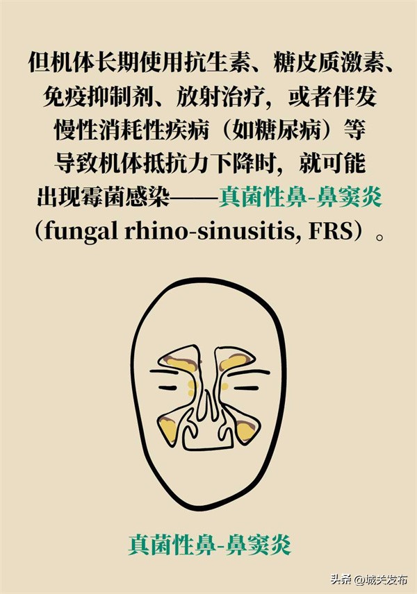 鼻子发霉怎么办,鼻子里因为异物发臭用什么药处理