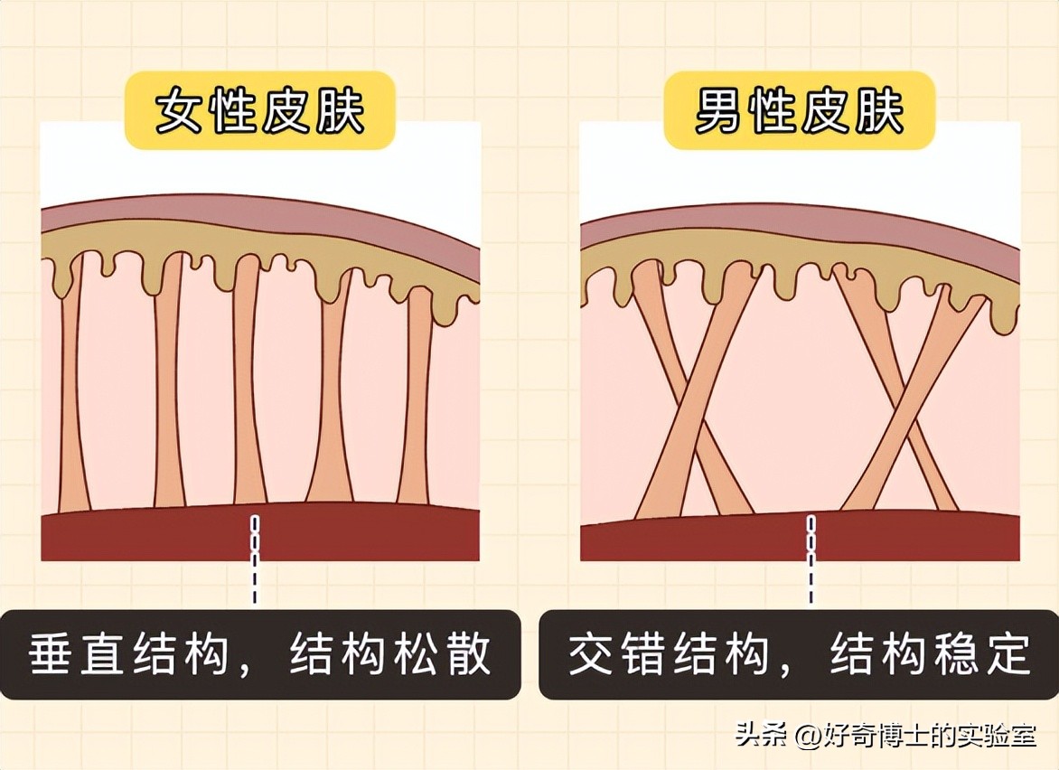 大腿上有白色条纹怎么回事,女生大腿外侧有红条纹是什么原因