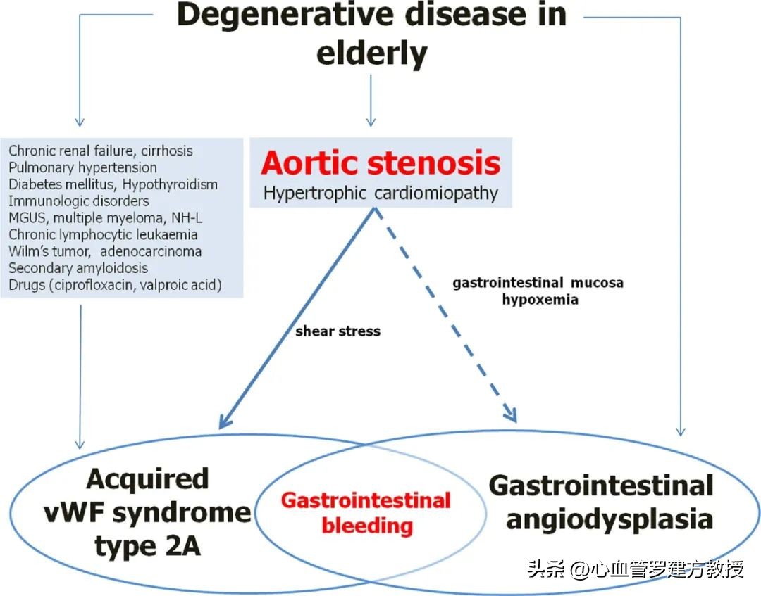 主动脉瓣狭窄的典型三联征表现,主动脉瓣狭窄治疗新技术