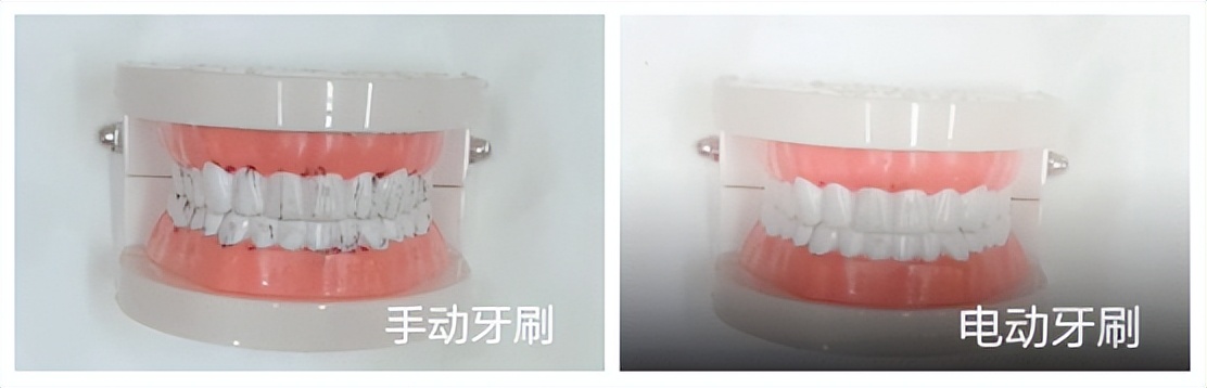 用电动牙刷对小孩有危害吗,孩子真有必要用电动牙刷吗