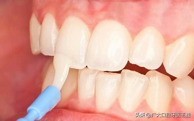 隐形牙套上面有白点,牙套上的白点是什么