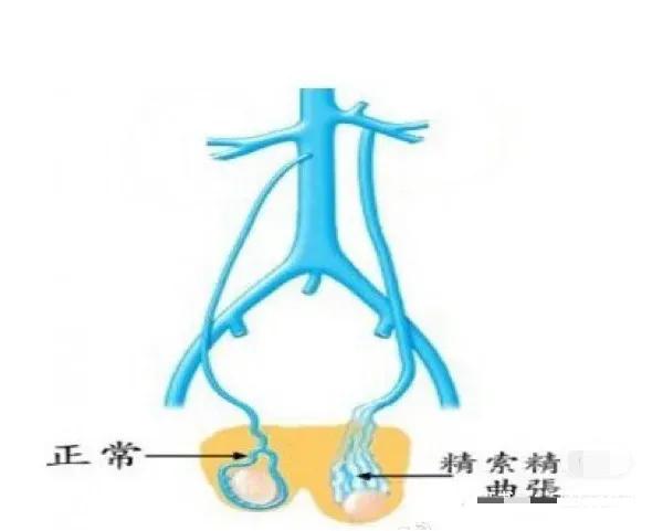 男性有哪些病不能怀孕,有六种病不需要治疗