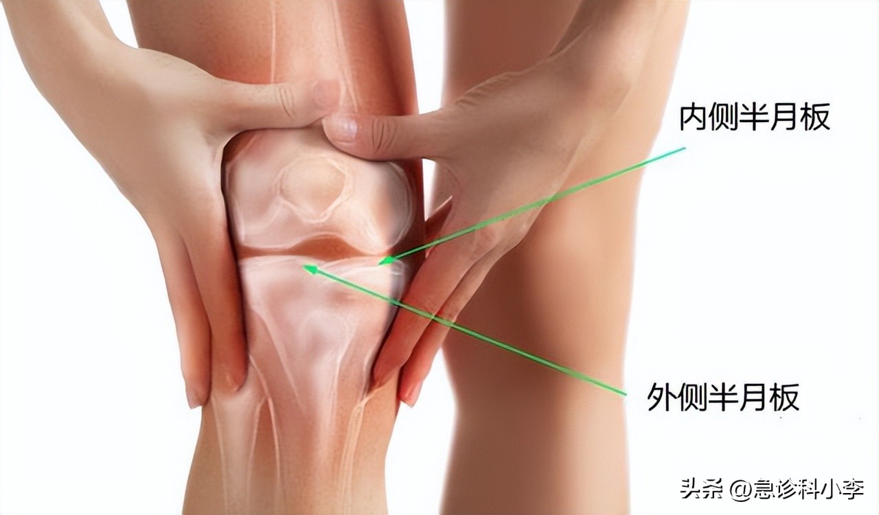 老人家膝盖半月板疼痛的治疗方法,65岁老人半月板损伤膝盖痛