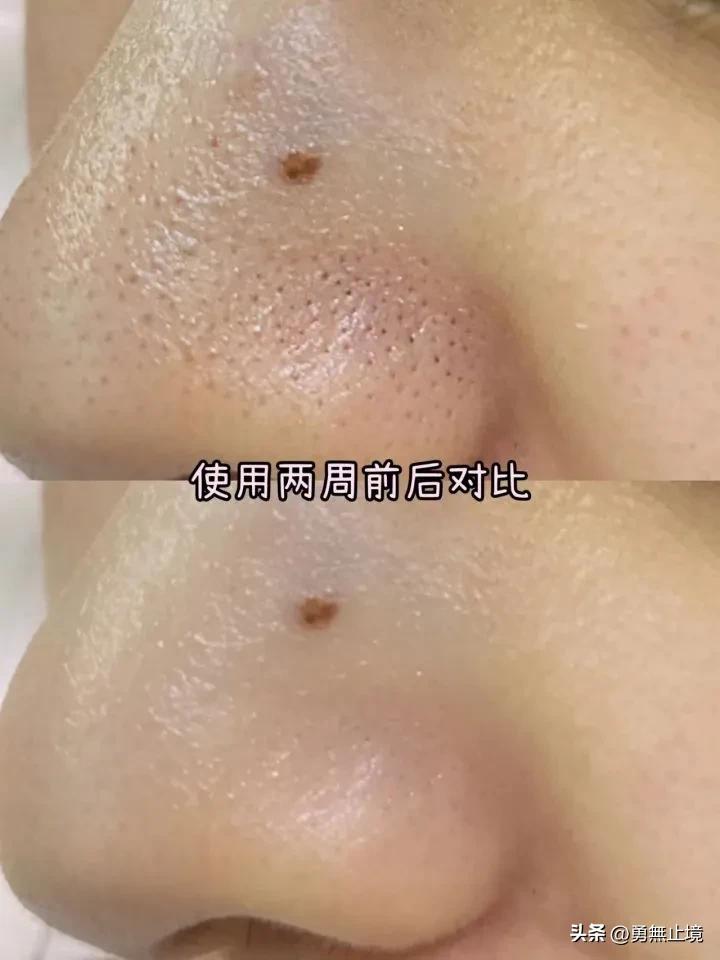 男士去黑头控油效果最好的洗面奶,2022男士洗面奶测评实测第一名