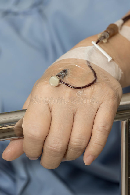 倪海厦讲抗疲劳的经方,倪海厦治胖子的经方