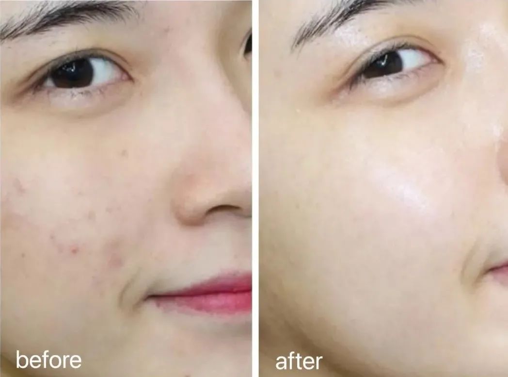 雪花秀祛黄提亮水乳推荐,韩国雪花秀润燥精华水乳7件套